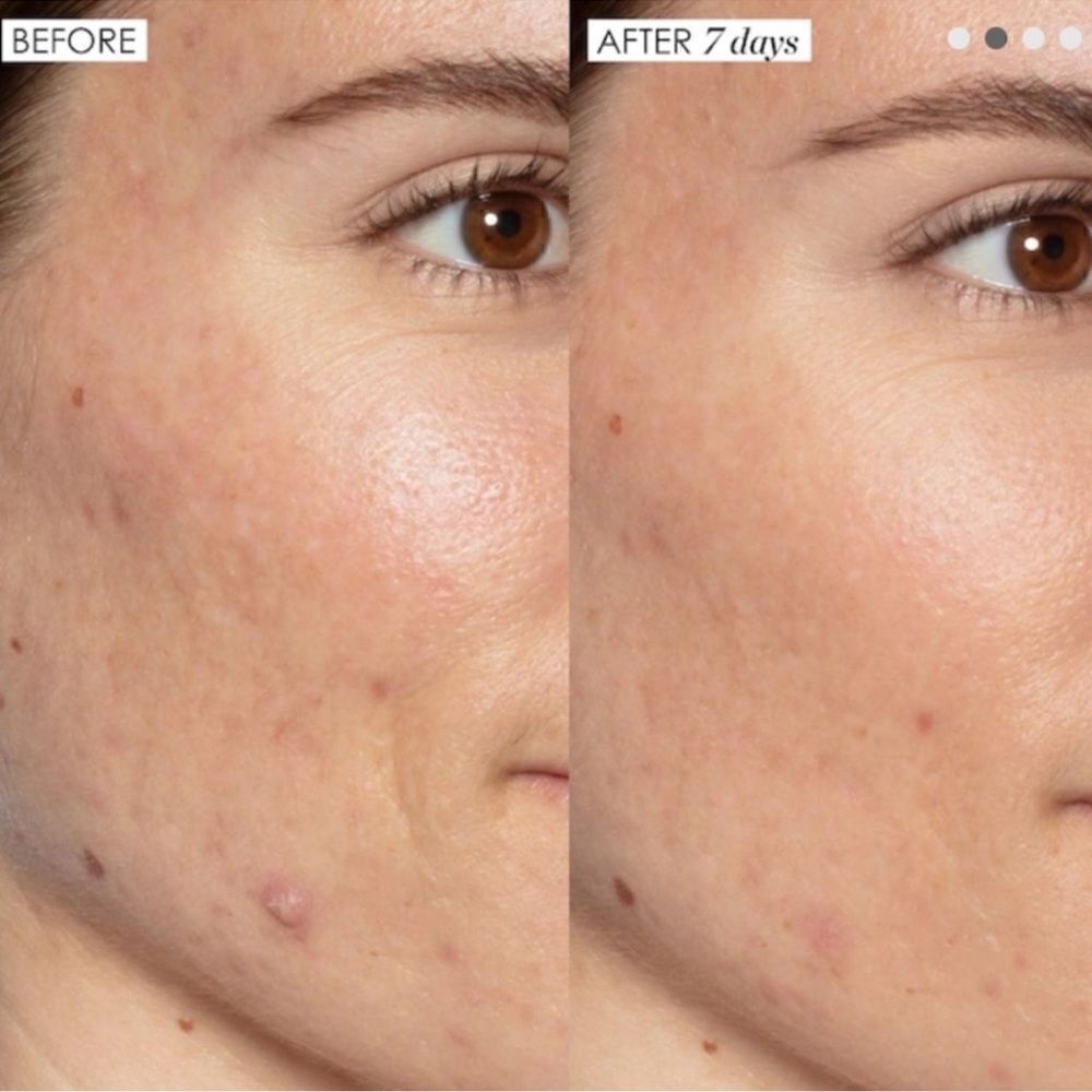 Sunday Riley Good Genes All-In-One Lactic Acid Treatment - Picture 6 of 9